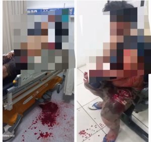 PERKELAHIAN DI RUSUN PUPR BERUJUNG PEMBACOKAN, SEORANG PRIA ALAMI LUKA PARAH