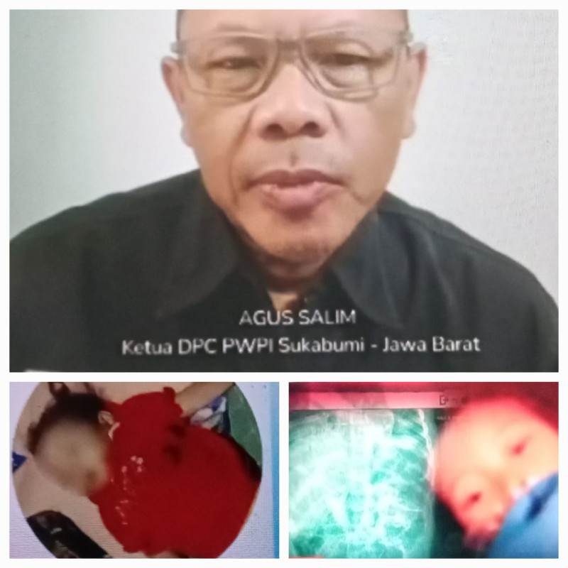 Ketua Persatuan Wartawan Duta Pena Indonesia (PWDPI) Kabupaten Sukabumi Menyoroti Tragedi Kematian Balita Usia 3 Tahun